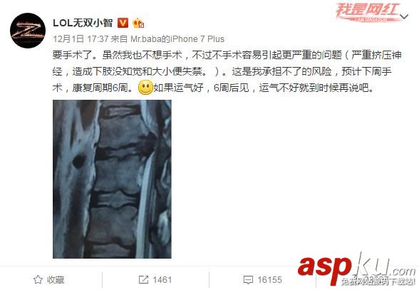 lol小智,lol小智手術(shù),lol小智怎么了,lol小智怎么沒直播了