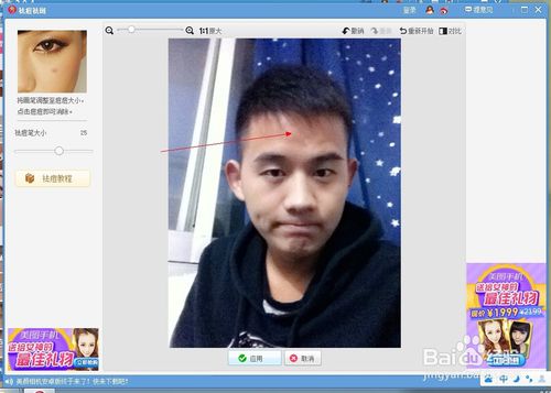 如何去除自己照片上的痘痘疤痕？