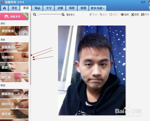 如何去除自己照片上的痘痘疤痕？