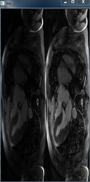 Python,cv2,圖像,自適應,灰度,直方圖